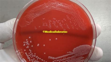 Listeria monocytogenes: Introduction, Morphology, Pathogenicity