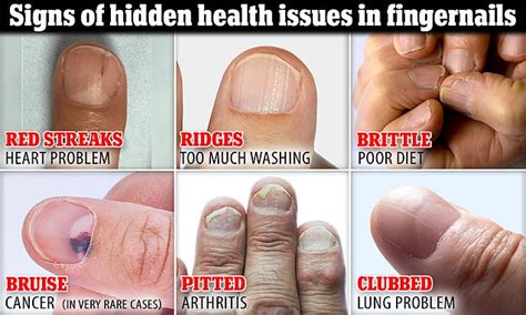 What do your fingernails say about you? Key signs can reveal clues to your overall health ...