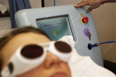 Laser wrinkle treatment - Stock Image - M590/0233 - Science Photo Library