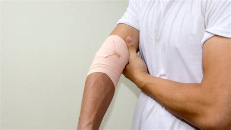 Total Elbow Arthroplasty: Questions for a Specialist - Hughston Clinic