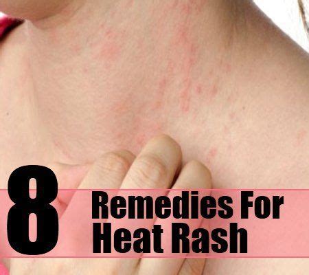 Skin Rash Treatment How To Treat Itchy Skin Rash Natu - vrogue.co
