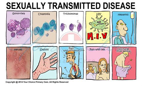 IllustrationSTD.jpg (3508×2126) | Sexually transmitted diseases, Sexually transmitted, Disease ...