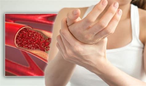 Blood clot in arm: Five changes to your arms that could be symptoms of a blood clot | Express.co.uk