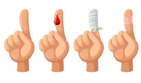 Cut Finger Vector Art, Icons, and Graphics for Free Download