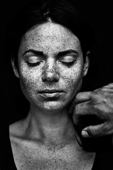 A freckled black and white portrait from the coffee table book "we are freckled" by the swedish ...