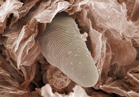 Eyelash Mite Tail, Sem Photograph by Power And Syred - Fine Art America