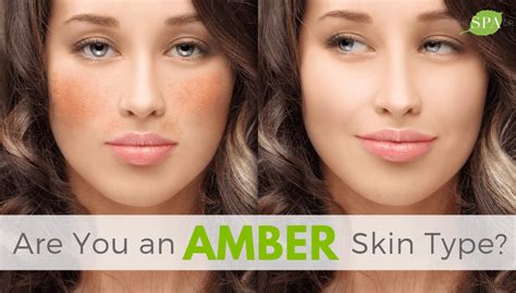 Are You an AMBER Skin Type? - The Spa Dr.®