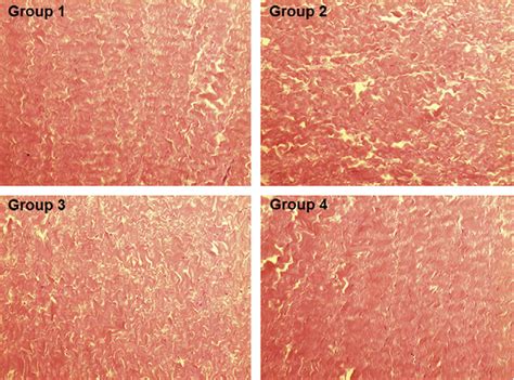 Figure 1 from High-concentration glutaraldehyde fixation of bovine ...