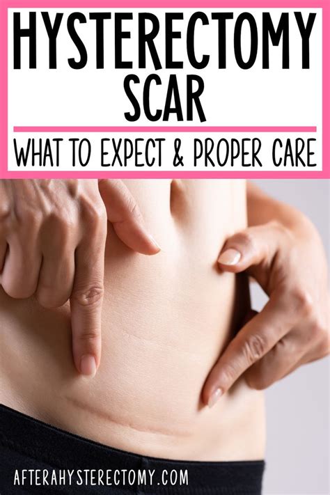 Hysterectomy Scar: What to Expect & Proper Care - After A Hysterectomy | Cough remedies, Natural ...