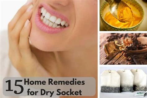 15 Home Remedies for Dry Socket - Wellness.guide