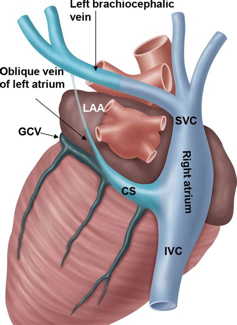 Figure 1b | Anatomical heart, Sonography, Cardiovascular