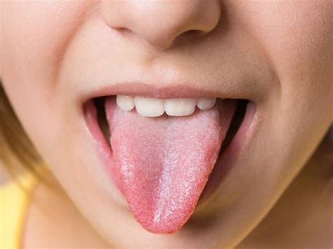 What does your tongue say about your health? | Vinmec