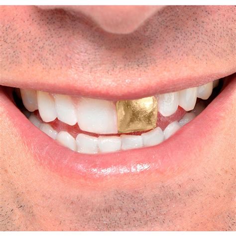 pegadinha fantasia Dente de Ouro - gold tooth