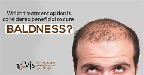 Which treatment option is considered beneficial to cure baldness?