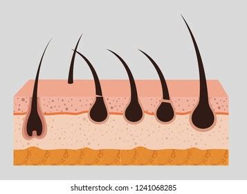 Layers Skin Structure Hair Removal Icons Stock Vector (Royalty Free) 1241068285 | Shutterstock