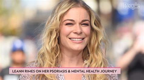 LeAnn Rimes Opens up About How Sharing Psoriasis, Mental Health ...