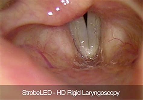 Laryngology – Ear, Nose, Throat – Olympus Medical Systems