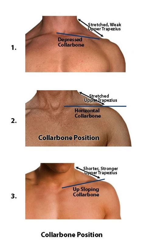 Pain In Left Collarbone Area And Neck at Janet Minner blog