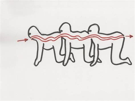 The Human Centipede (surgery) | The Human Centipede Wiki | FANDOM ...