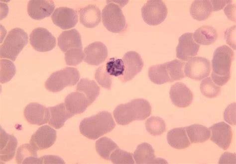 Free picture: blood smear, old, immature, schizont, plasmodium malariae