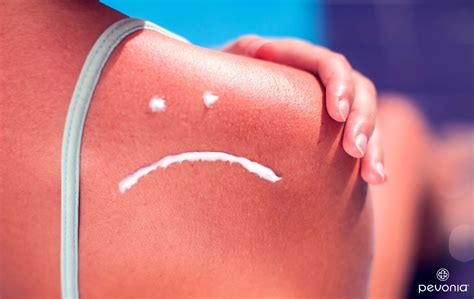 Damage Control: How to Prevent and Correct Sun Damaged Skin