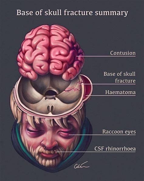 Pin by Brianne Olsen on Did someone call a nurse? | Medical knowledge, Medical illustration ...