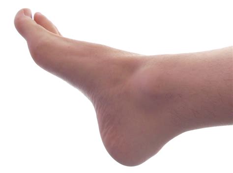 ファイル:Male Right Foot 1.jpg - Wikipedia