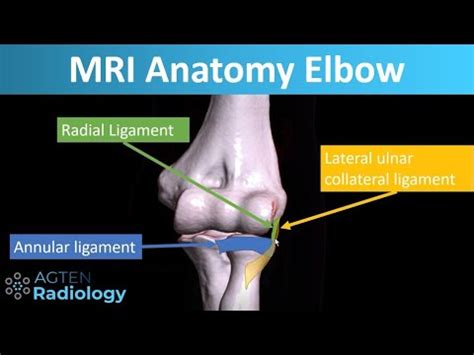 MRI Anatomy of Lateral Elbow Ligaments - YouTube