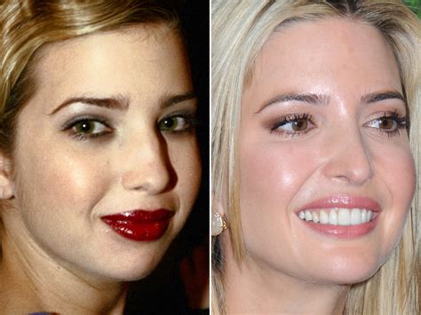 Ivanka Trump Before and After: From 1995 to 2022 - The Skincare Edit