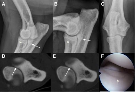 Assessment of medial coronoid disease in 180 canine lame elbow joints: a sensitivity and ...