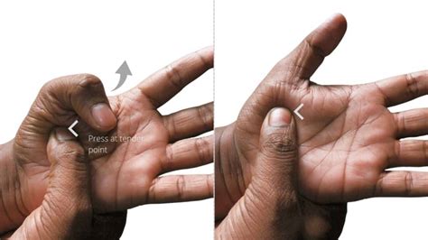 4 Effective Trigger Thumb Exercises and Tips to Ease Pain