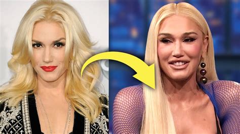 Gwen Stefani's New Plastic Surgeries and What Made Her Unrecognizable ...