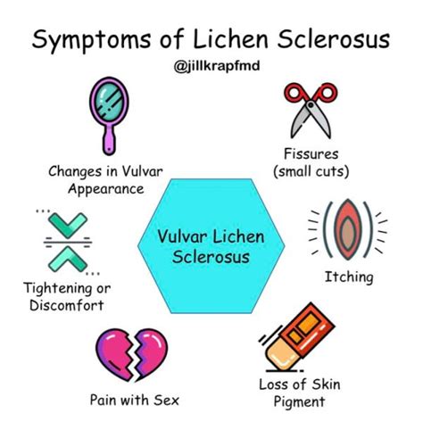 Vulvar Lichen Sclerosus: It’s Not Just Itching – Jill Krapf MD