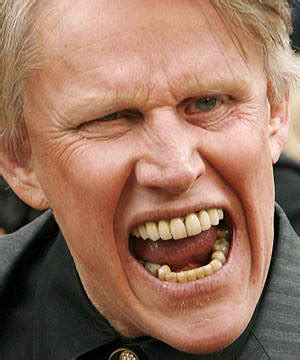 Gary Busey Brain Injury