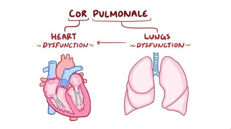 cor pulmonale,what to know?