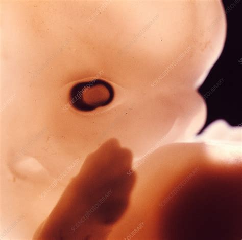 Embryo, five weeks - Stock Image - C048/7911 - Science Photo Library