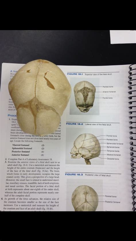 Fetal skull | Anatomy and physiology, Fetal, Skull