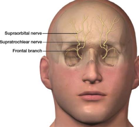 Supraorbital Nerve V1