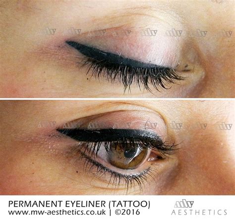 permanent eyeliner (tattoo) picture taken straight after the procedure ...