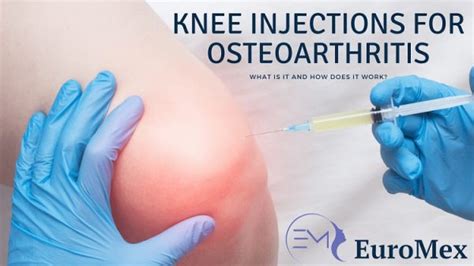 Knee Injections for Osteoarthritis - what is it and how does it Work? - EuroMex