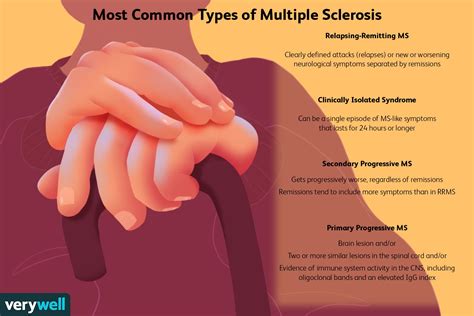 Types of Multiple Sclerosis (MS): Progression, Outlook