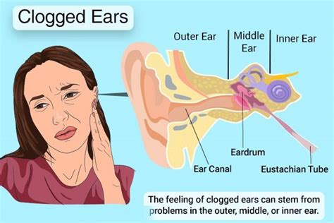 Quick Way To Unblock Ears - Anna Blog