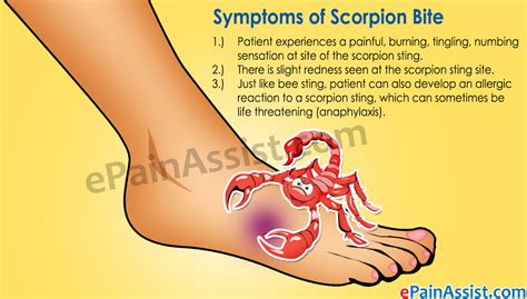 Scorpion Bite|Symptoms|Home Remedies|First Aid|Treatment