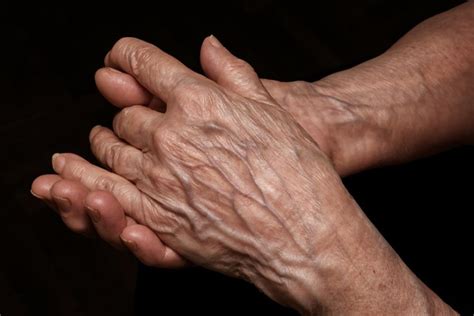 Why are hand veins prominent in some people?