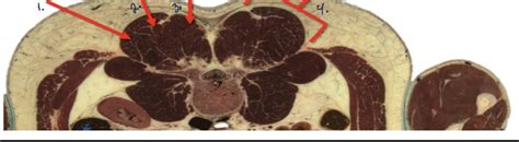 Labeling Epaxial Muscles Lab 6 Diagram | Quizlet