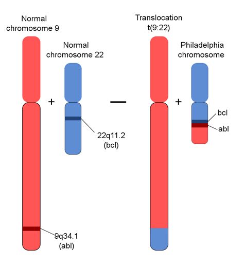 Translocation, Genetic; Chromosomal Translocation; Translocation, Chromosomal