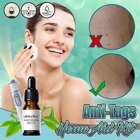 Skin Tag Remover Essence Flat Warts Removal Mole & Papillomas Foot Plantar Warts | Fruugo FR