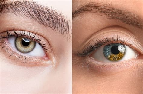 Hazel Eyes vs. Central Heterochromia: What's the Difference?