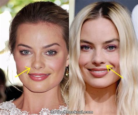 Margot Robbie Plastic Surgery Comparison Photos