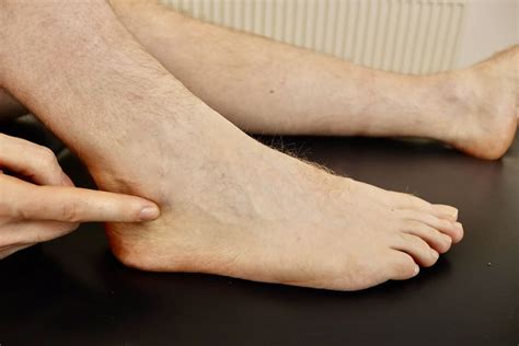 Peroneal Tendonitis: The most common questions answered